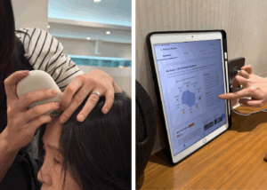 My mum received a full English report with insights into her scalp condition